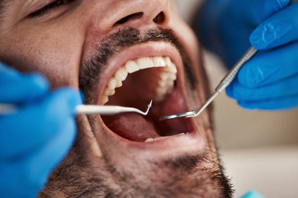 Best Emergency Cosmetic Dentistry (e.g., broken veneers) in St Ansgar, IA